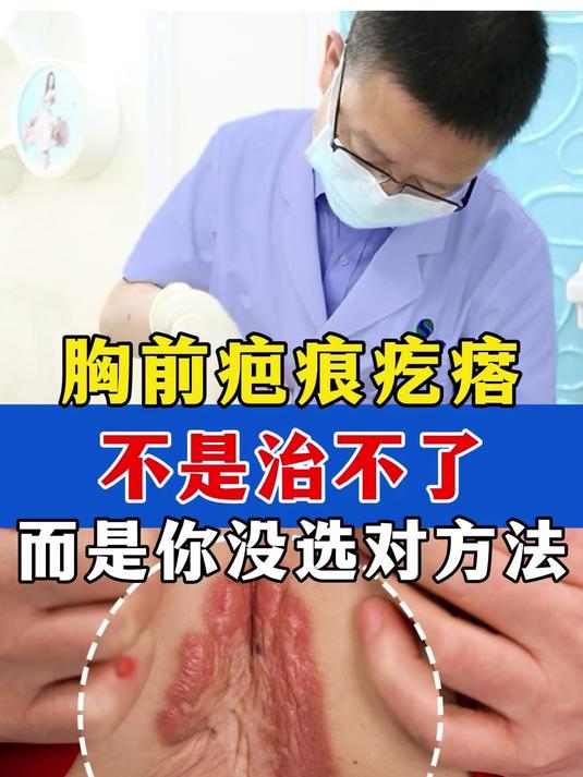 从小疮长成肉疙瘩,又痒又痛的疤痕疙瘩怎么办?