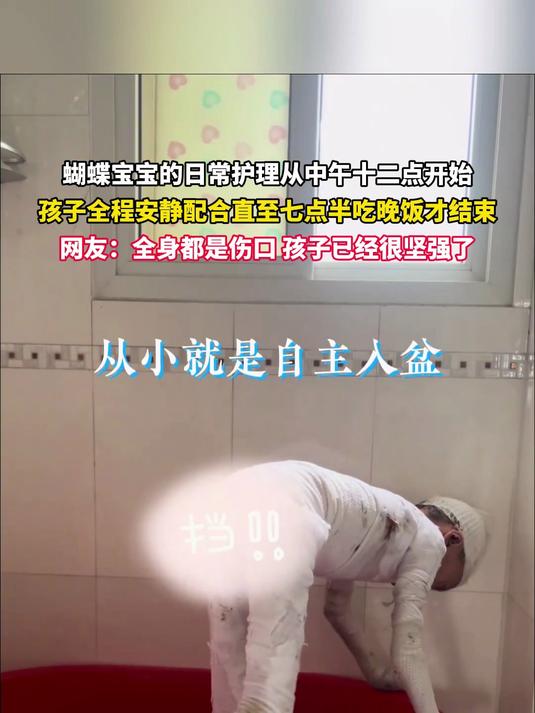 蝴蝶宝宝的日常护理从中午十二点开始，孩子全程安静配合直至七点半吃晚饭才结束。