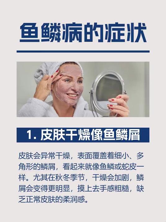 鱼鳞病的症状