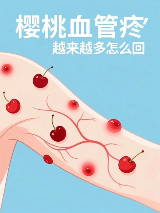 樱桃血管痣越来越多怎么回事 #健康扬帆季#