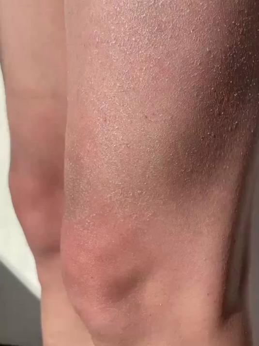 鱼鳞皮蛇皮腿,快来看看