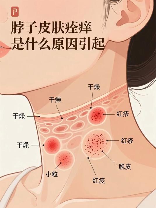 脖子皮肤瘙痒是什么原因引起 #健康扬帆季#