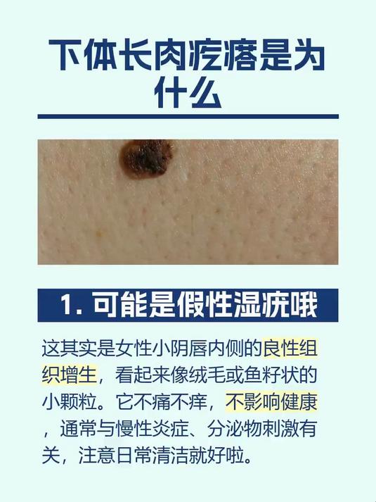 #马上健康过大年#下体长肉疙瘩是为什么