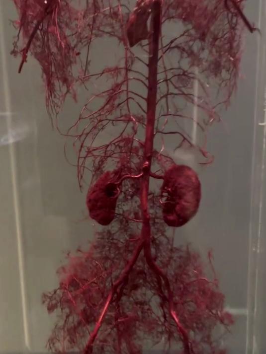 致敬真实器官标本!你了解你的肾吗