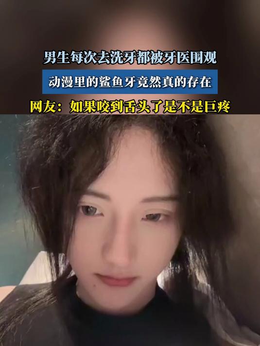 男生每次去洗牙都被牙医围观,动漫里的鲨鱼牙竟然真的存在