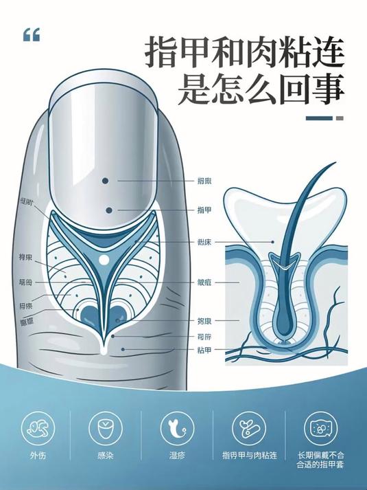 指甲和肉粘连是怎么回事