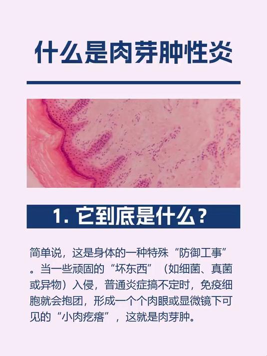 #马上健康过大年#什么是肉芽肿性炎