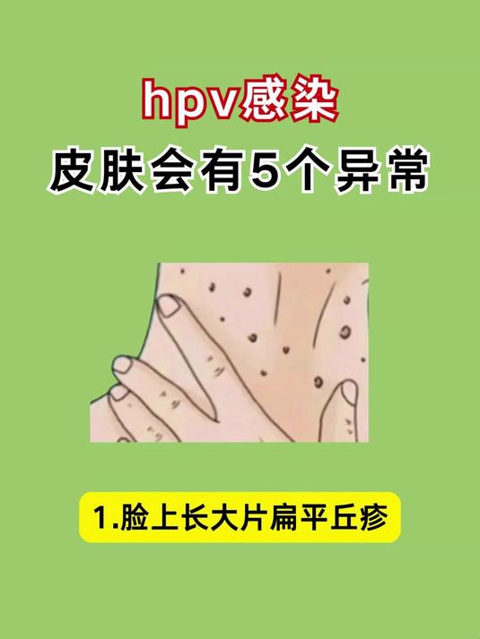 hpv感染皮肤会有5个异常