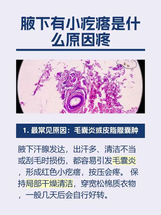 腋下有小疙瘩是什么原因疼