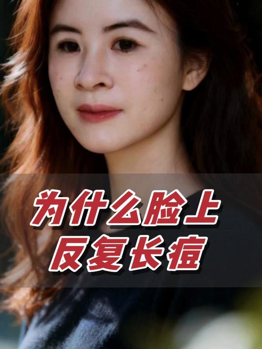 为什么脸上反复长痘!