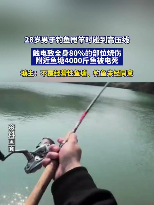 28岁男子钓鱼甩竿时碰到高压线触电,致全身80%的部位烧伤