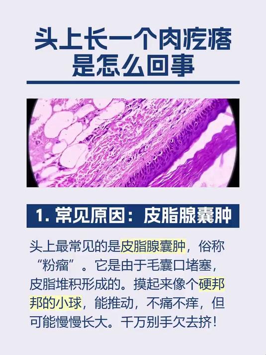 #马上健康过大年#头上长一个肉疙瘩是怎么回事