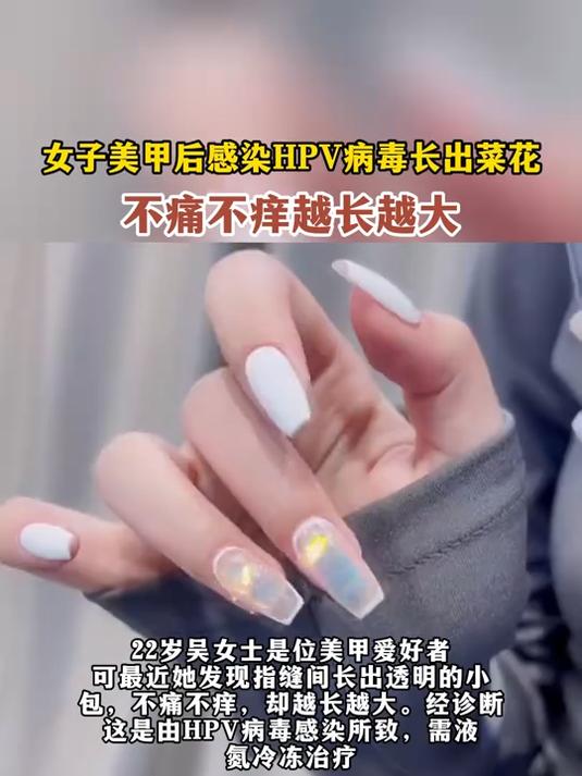 女子美甲后感染HPV病毒长出菜花,不痛不痒越长越大