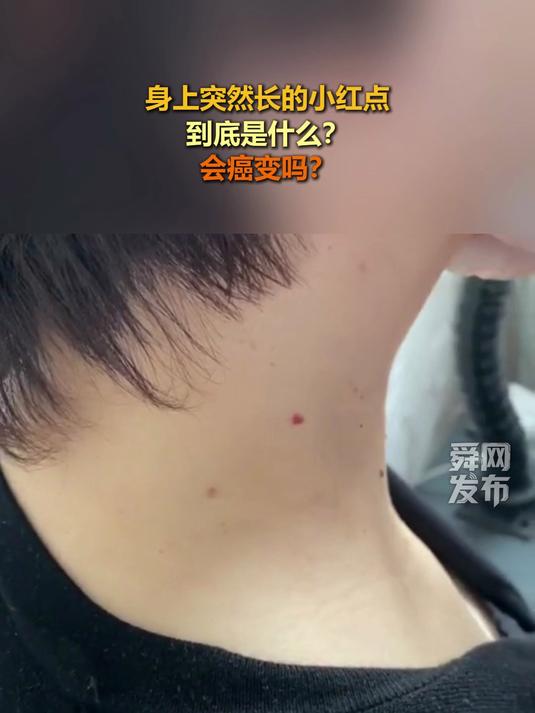 身上突然长的小红点,到底是什么?会癌变吗?