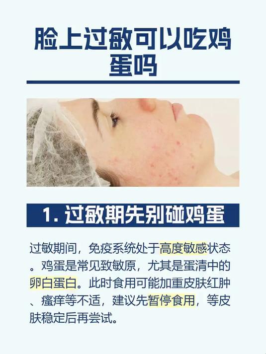 脸上过敏可以吃鸡蛋吗