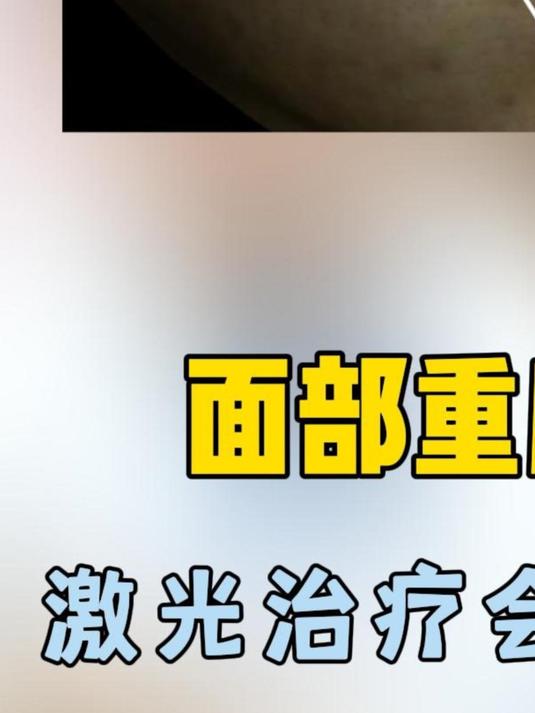 面部重度痘坑激光治疗会有效果吗