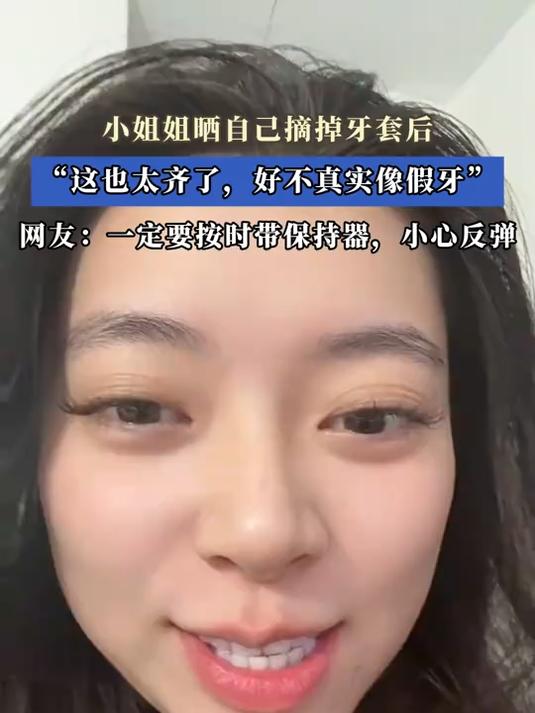 小姐姐晒自己摘掉牙套后“这也太齐了，好不真实像假牙”