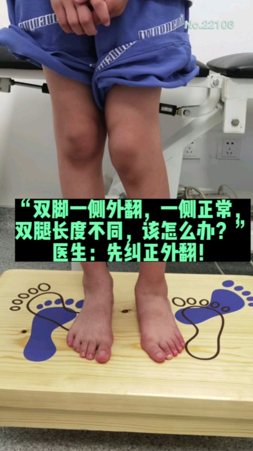 “双脚一侧外翻,一侧正常, 双腿长度不同,该怎么办?” 医生:先纠正外翻!