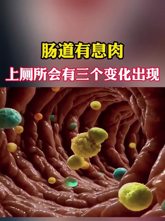 肠道有息肉上厕所会有三个变化出现每一个都要重视