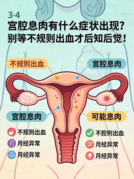 宫腔息肉有什么症状出现?别等不规则出血才后知后觉!