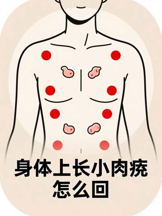 身体上长小肉疣怎么回事