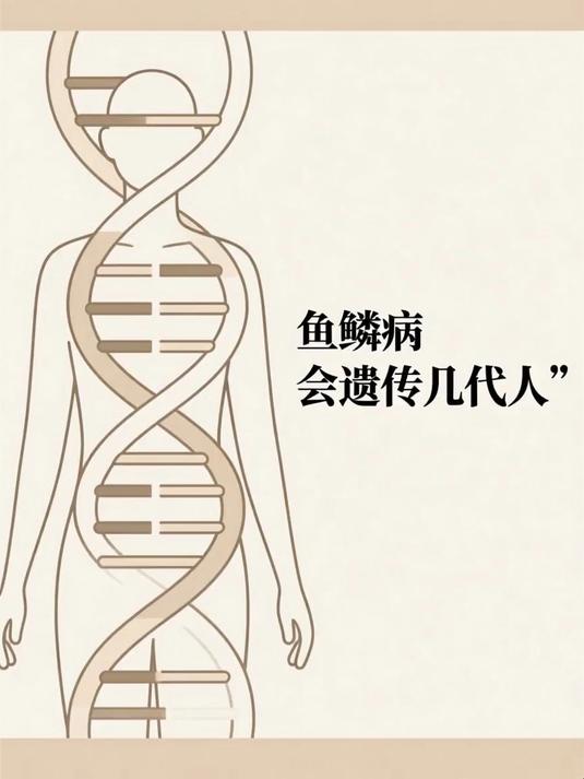 鱼鳞病会遗传几代人