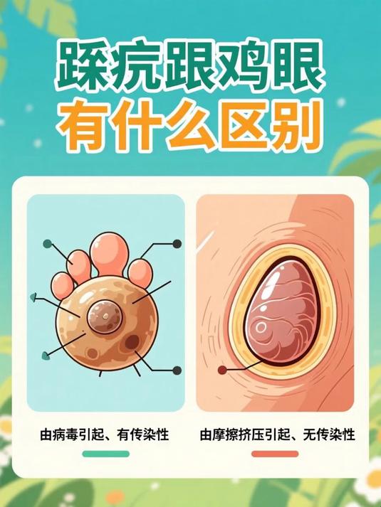 跖疣跟鸡眼有什么区别 #健康扬帆季#