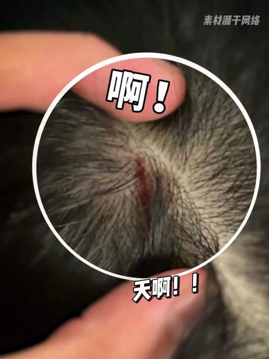鲨鱼夹安全隐患……太吓人了
