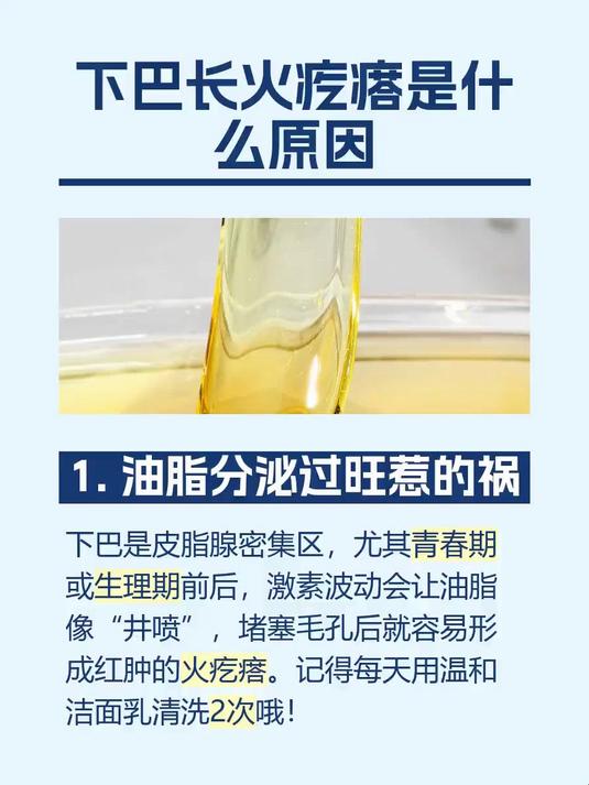 #马上健康过大年#下巴长火疙瘩是什么原因