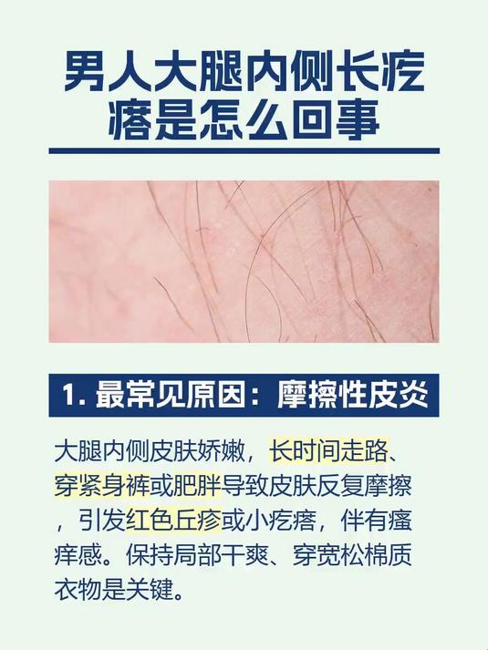 男人大腿内侧长疙瘩是怎么回事