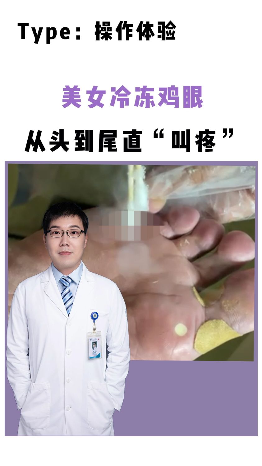 美女冷冻鸡眼,从头到尾直喊“疼”!
