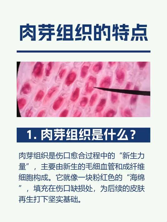 肉芽组织的特点
