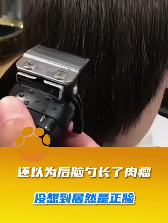 还以为后脑勺长了肉瘤,没想到居然是正脸
