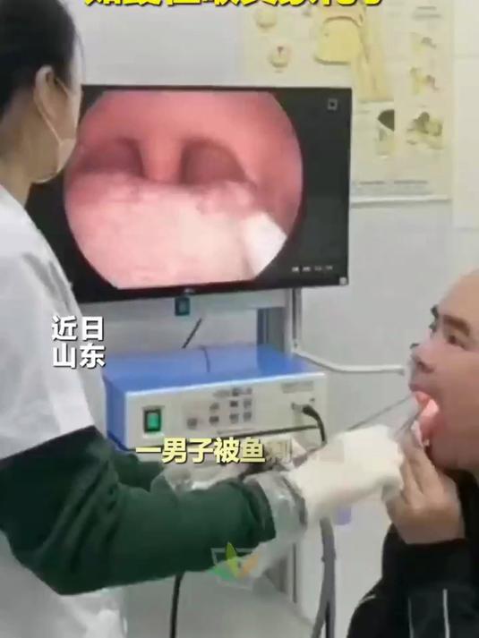 一男子被鱼刺卡喉 医生淡定操作 稳拔鱼刺