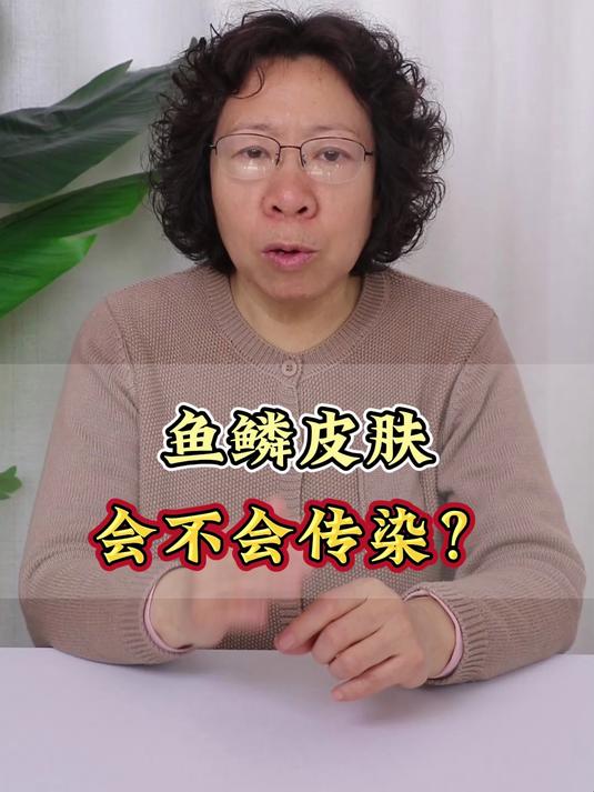 鱼鳞皮肤会不会传染?
