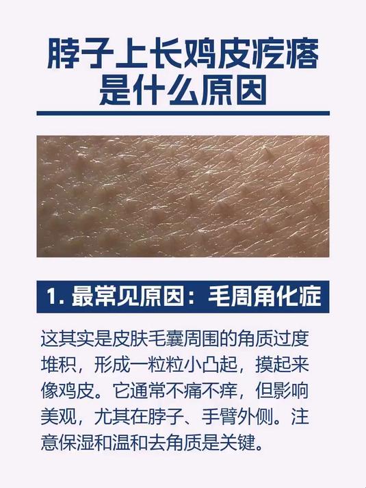 脖子上长鸡皮疙瘩是什么原因
