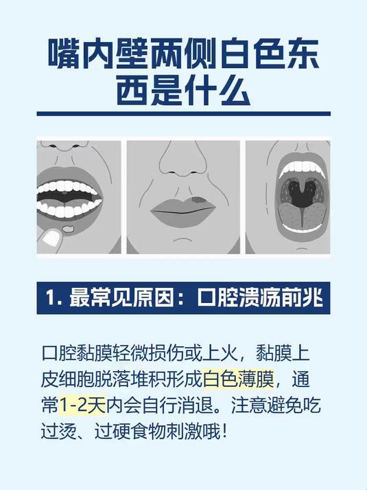 #马上健康过大年#嘴内壁两侧白色东西是什么