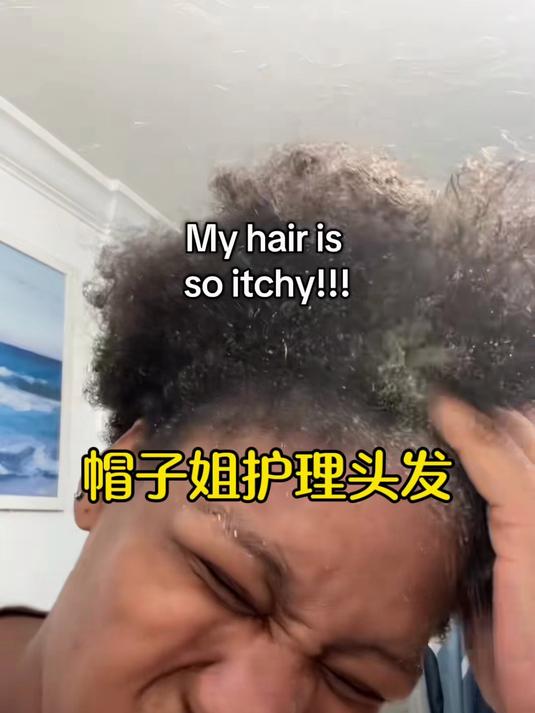 帽子姐护理头发