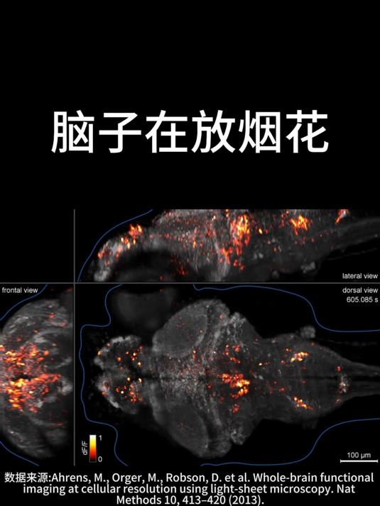 大脑中的烟花-斑马鱼幼鱼全脑光片显微镜钙成像