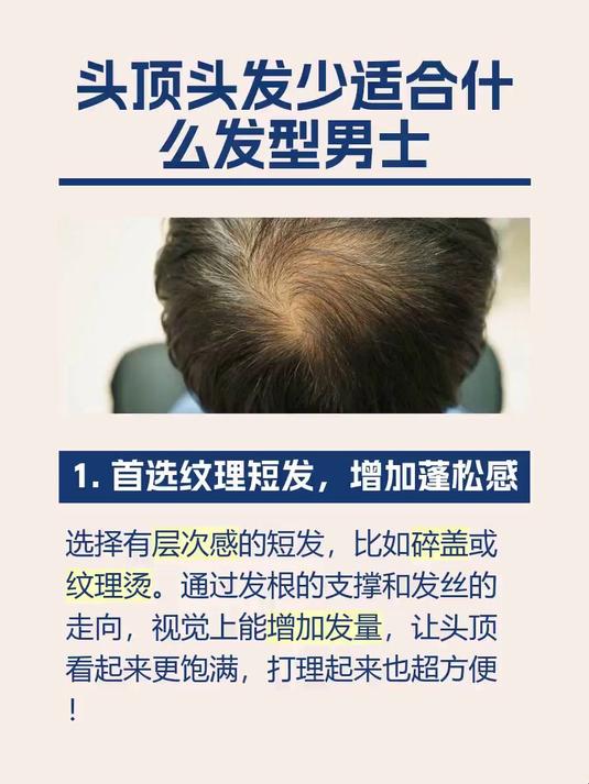 #马上健康过大年#头顶头发少适合什么发型男士