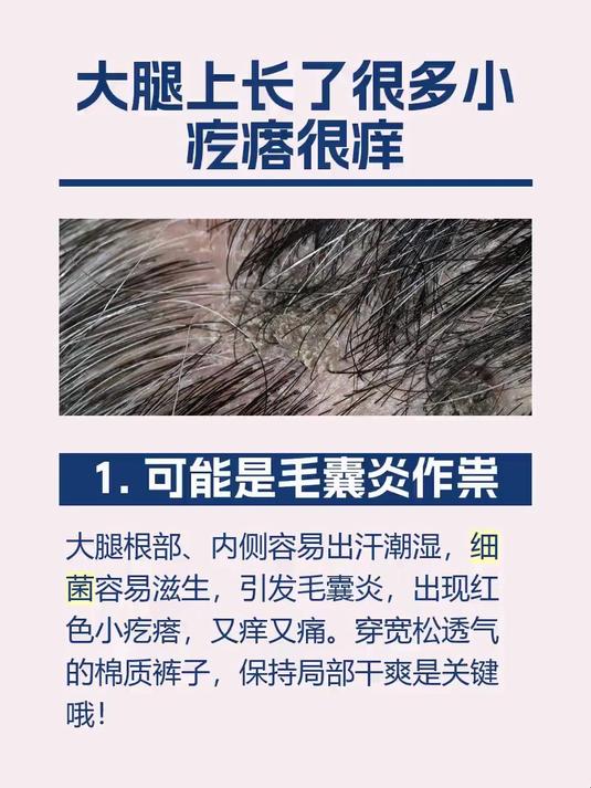 大腿上长了很多小疙瘩很痒