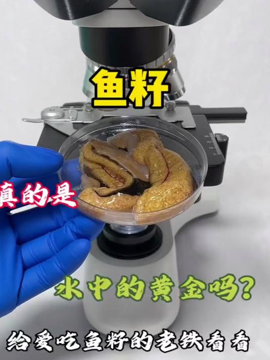 鱼籽你喜欢吃吗?