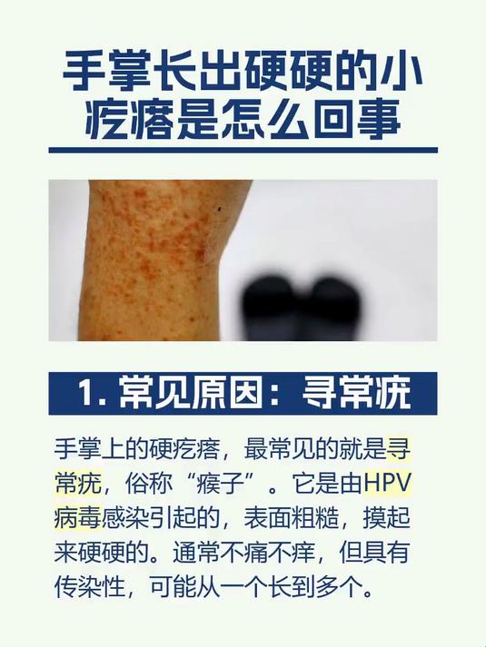 手掌长出硬硬的小疙瘩是怎么回事