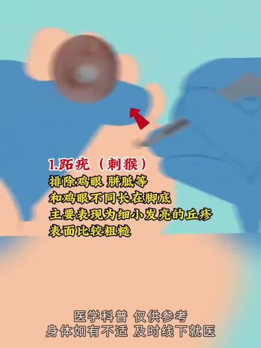 发现这些皮肤异常或感染HPV病毒