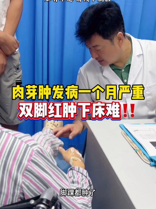 肉芽肿发病一个月严重,双脚红肿下床难