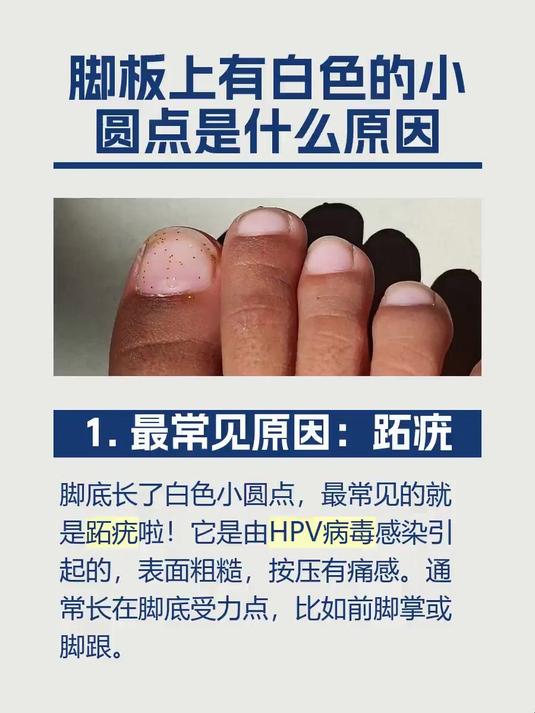 脚板上有白色的小圆点是什么原因