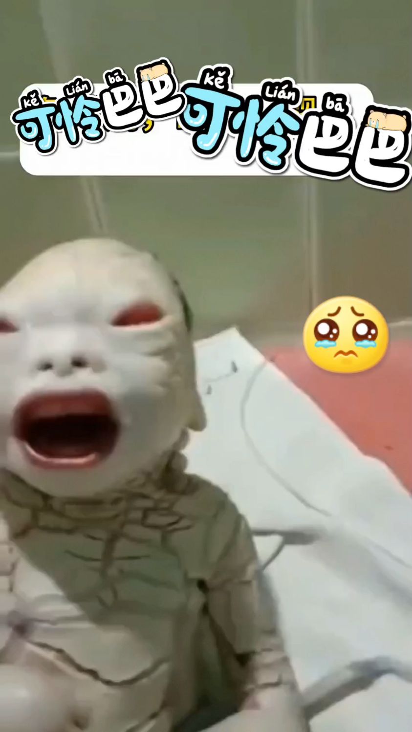 刚刚出生的宝宝鱼鳞病