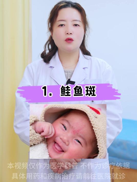 这3种胎记虽然都是红色的,但性质不同需要进行针对性治疗