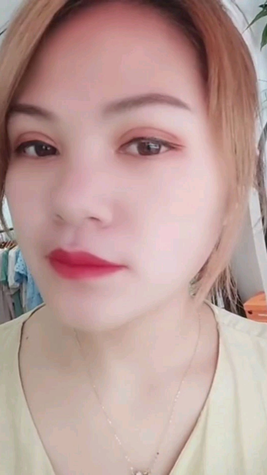 全切双眼皮第205天效果,割的有点深,有肉条感!
