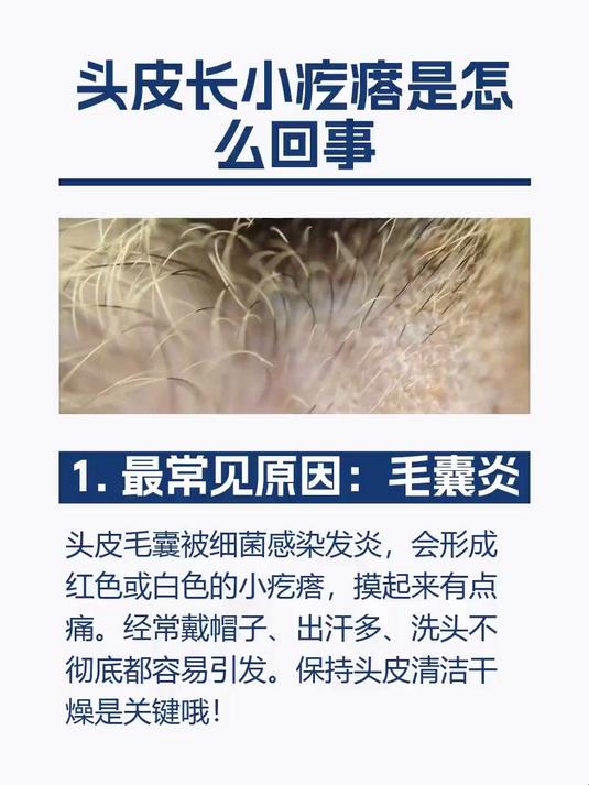 #马上健康过大年#头皮长小疙瘩是怎么回事